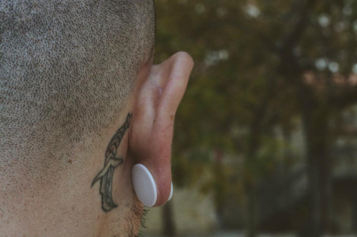 Universiteit lasert tattoos gratis weg bij werklozen