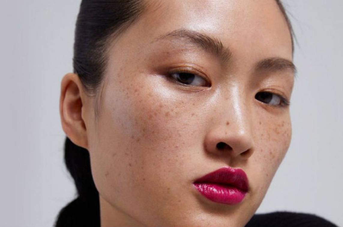 Zara beledigt China met... sproetjes