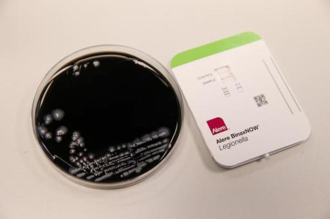 Twee nieuwe meldingen van legionella in Gentse kanaalzone