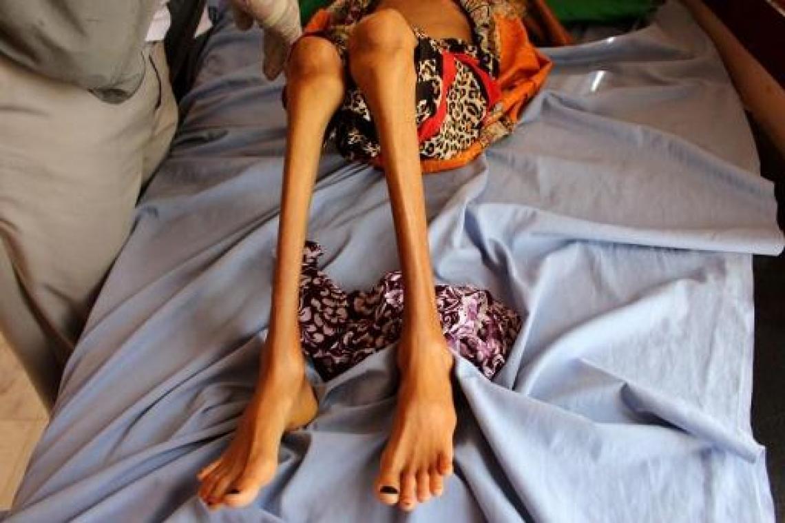 Wereldvoedselprogramma dreigt met opschorting hulp in Houthi-gebieden