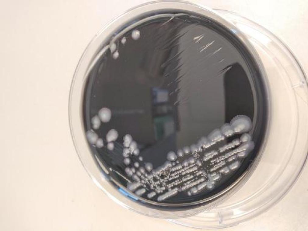 27ste legionellapatiënt opgenomen in het ziekenhuis
