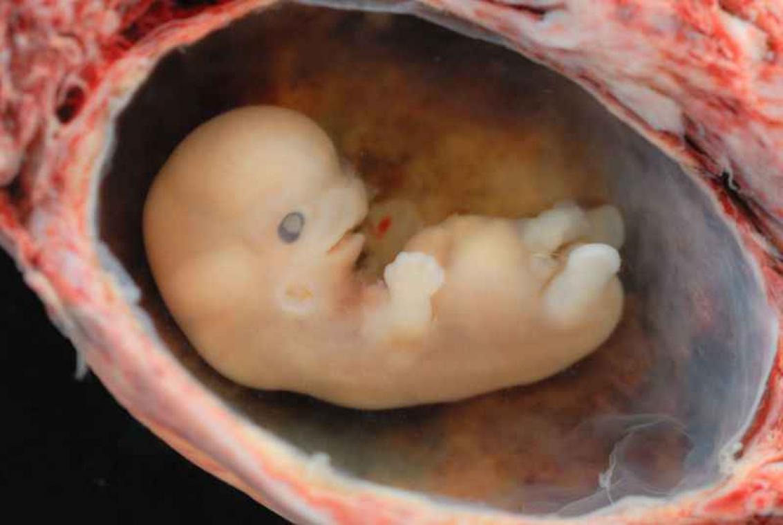 Hiv-resistente embryo's veroorzaken ophef