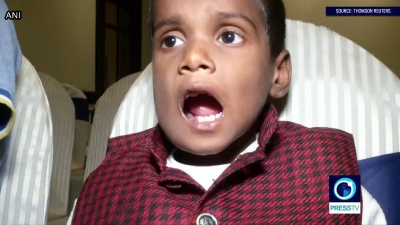 VIDEO. Indiase artsen halen 526 tanden uit mond van 7-jarige jongen
