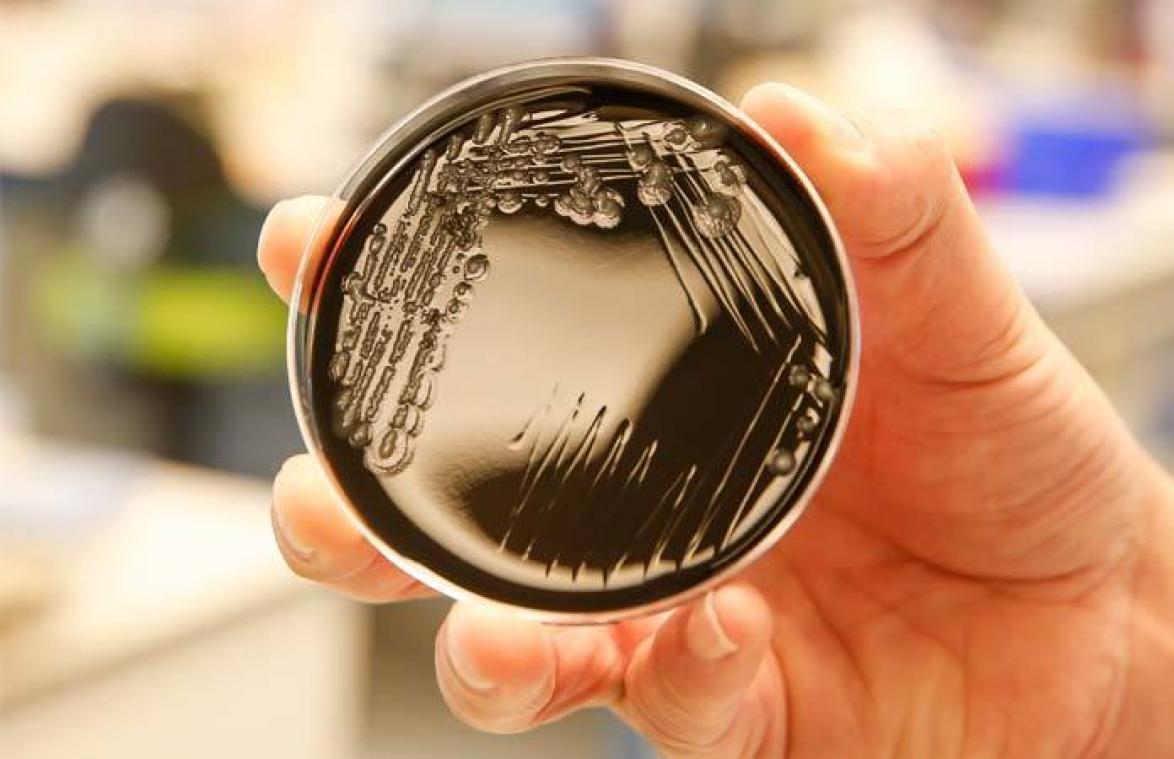 Dit kan je doen om besmetting met legionella te voorkomen
