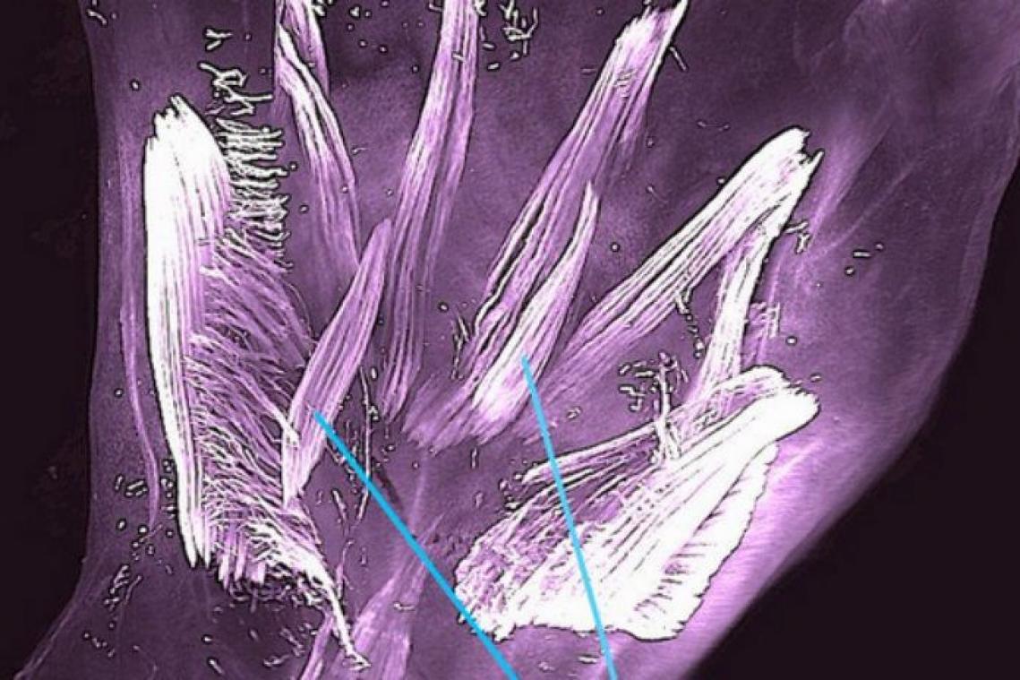 Ongeboren baby's hebben 'hagedisachtige' spiertjes in hand