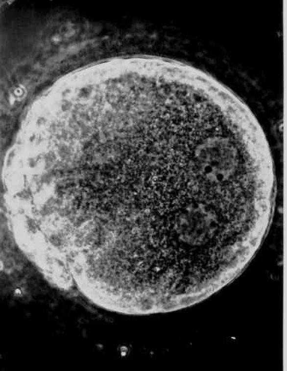 Leuvense onderzoekers ontdekken celdeling met chromosomen van ouders in aparte cellen