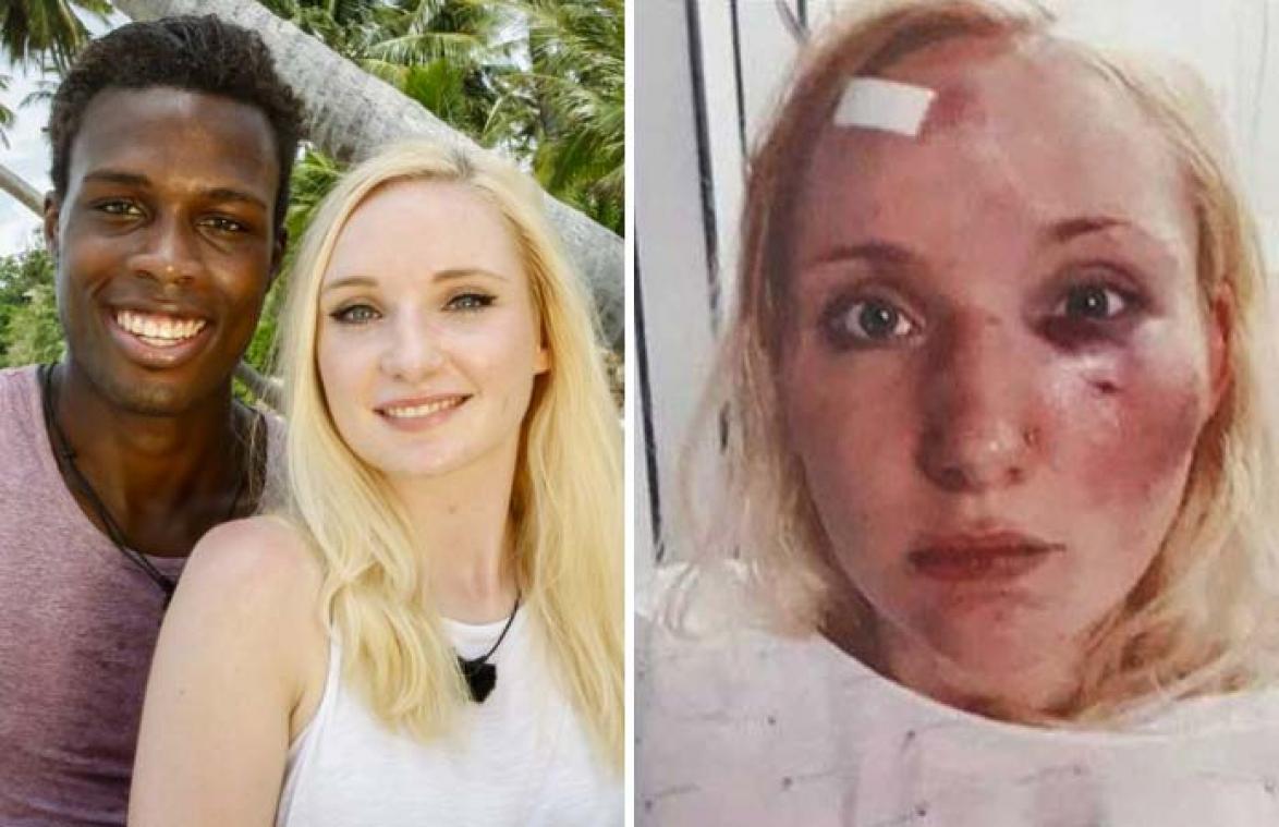 Laura uit 'Temptation Island' in elkaar geslagen door misnoegde kijkers (foto's)