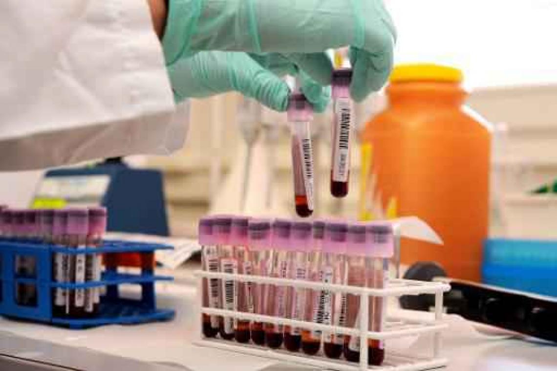 België volgens WADA-onderzoek in top vijf dopinginbreuken in 2014