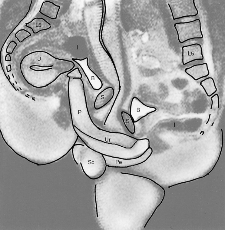 Studie met eerste MRI-scan van vrijend koppel is nog steeds populair: "gratis seksfoto's werken"