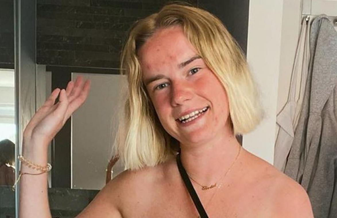Vlaamse influencer zet haar onvolmaaktheden in de kijker: "De meeste mannen zijn hier niet klaar voor"