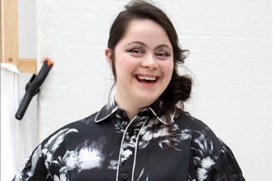 Tiener met downsyndroom wordt model voor Gucci en Vogue Italia