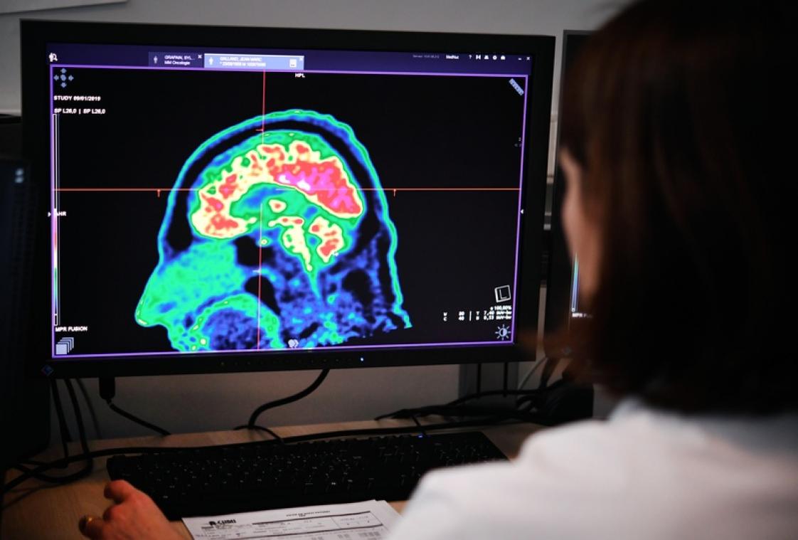 Coronavirus: neurologen waarschuwen voor ernstige hersenaandoeningen bij patiënten met milde symptomen