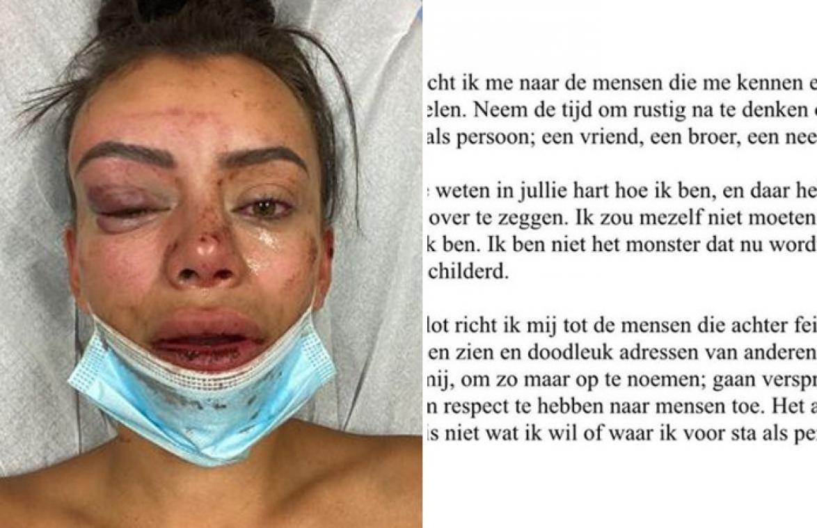 Man die 'Temptation'-Yasmine in elkaar sloeg, reageert: "Ik ben geen monster"