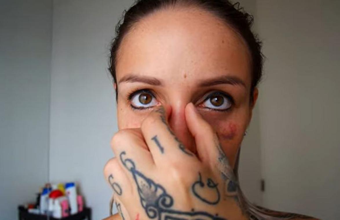 'Temptation'-Pommeline toont haar nieuwe neus na chirurgische ingreep (foto)