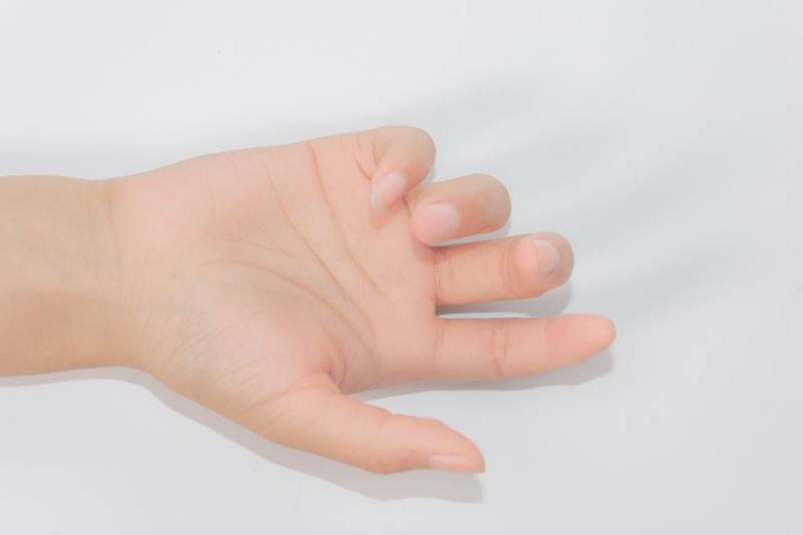 BIZAR. Vrouw zaagt eigen hand af en moet naar de gevangenis