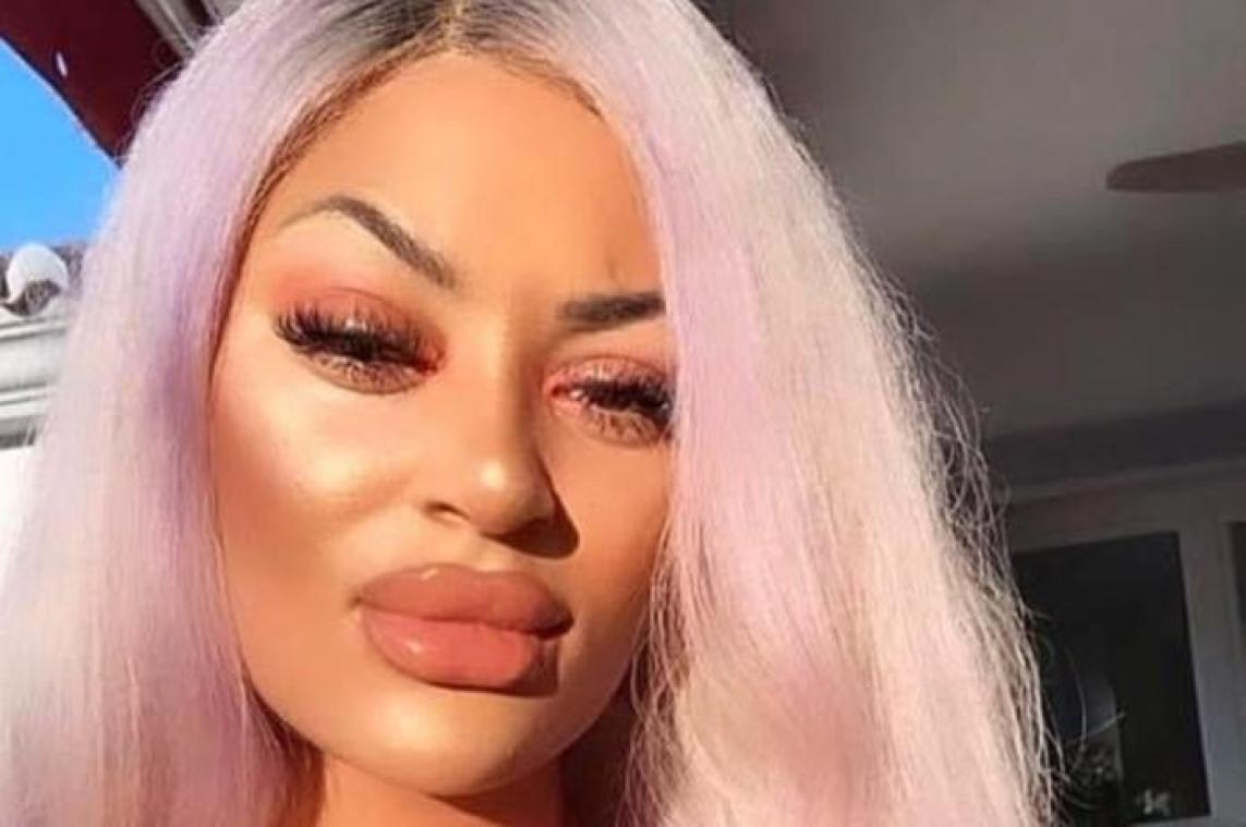 BIZAR. Vrouw verliest tepel na borstvergroting in Turkije: "Mijn borst ruikt naar rottend vlees"