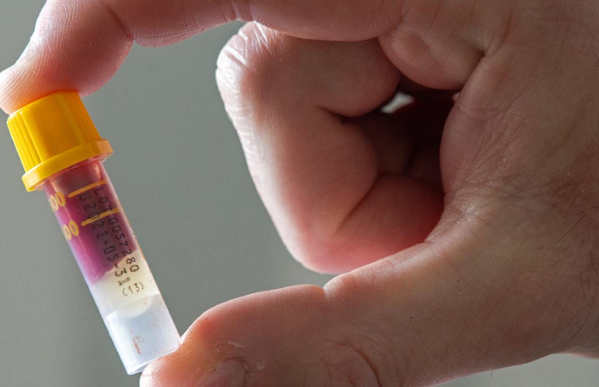 Mensen met DEZE bloedgroep hebben minder kans om het coronavirus op te lopen