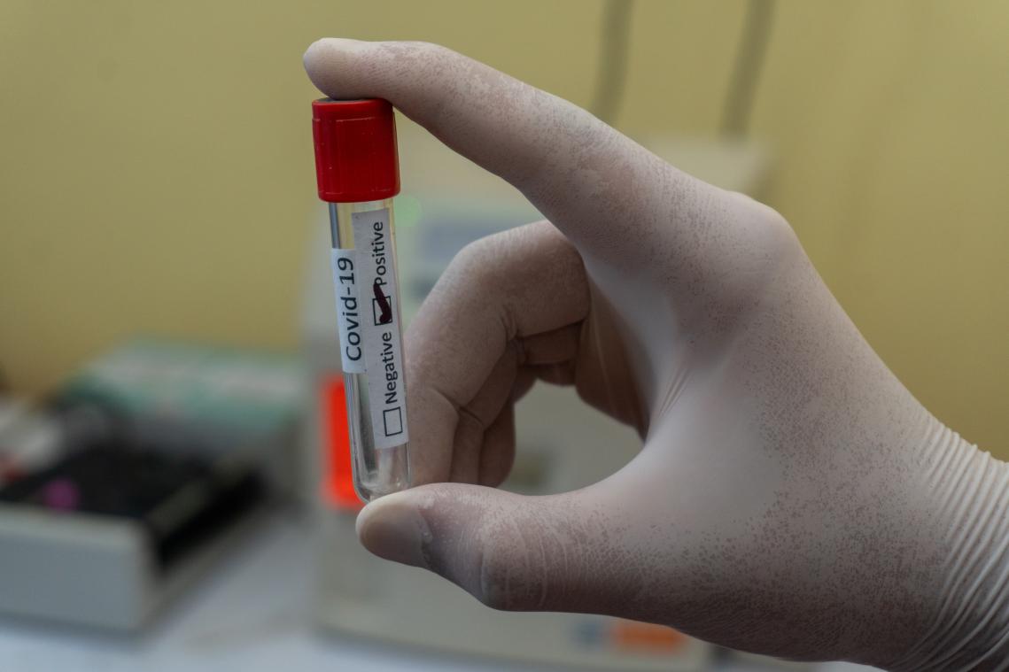 Asymptomatische mensen met hoogrisicocontact vanaf vandaag opnieuw getest