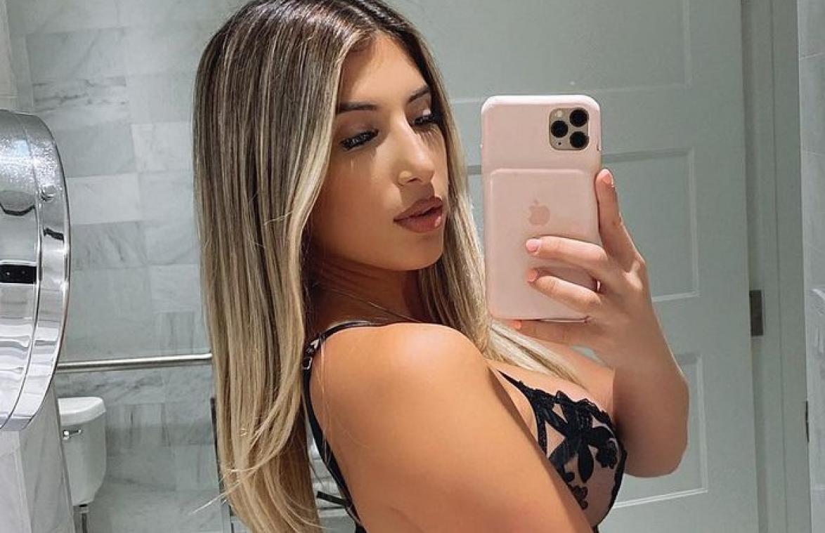 Model krijgt massa's respect omdat ze cellulitis toont in onbewerkte bikinifoto