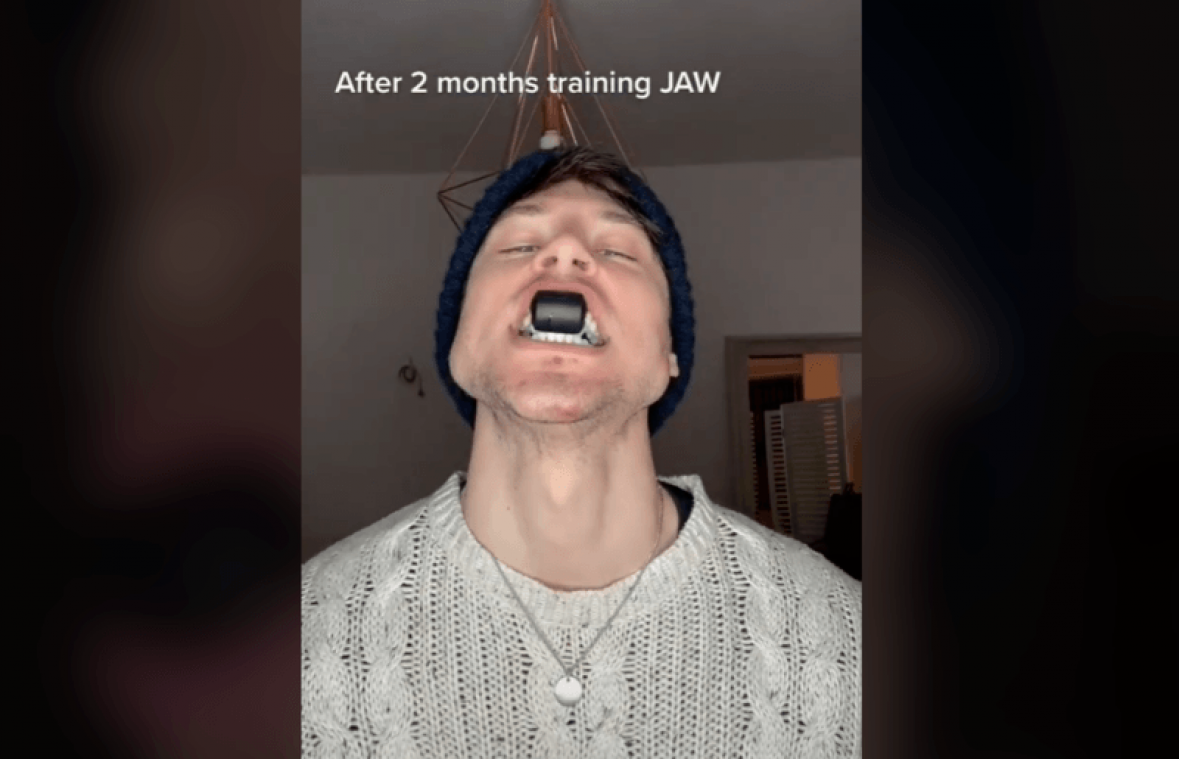 Model toont zijn gigantische kaaklijn na twee maanden training: "Is dit erover?" (video)