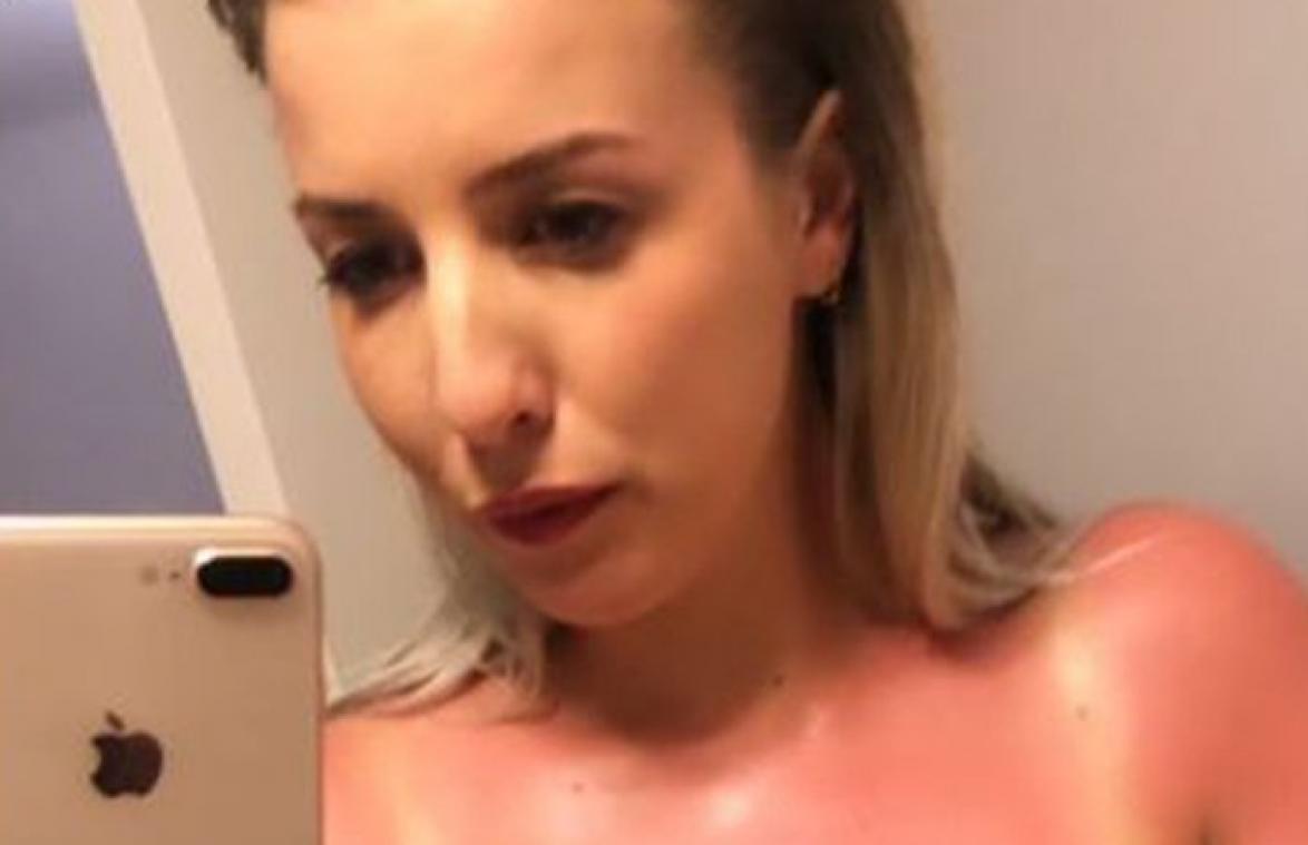 Laura uit 'Blind Getrouwd' toont pijnlijk resultaat van te lang in de zon te zitten: "Dat wordt wel bruin" (foto)