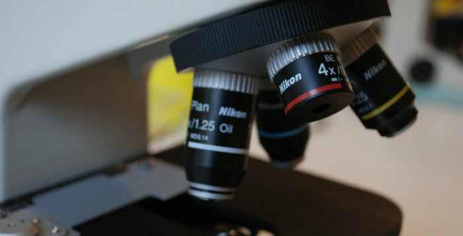 KU Leuven dichter bij aidsmedicijn