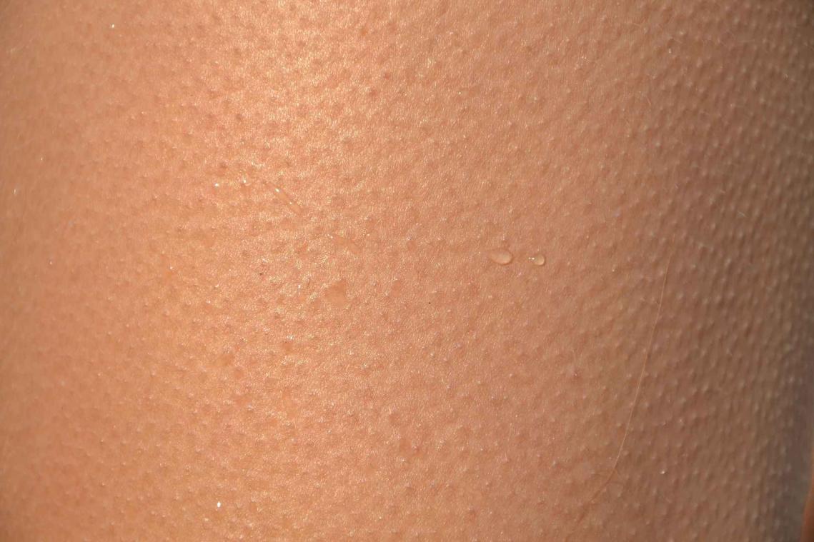 Daarom krijg je kippenvel wanneer je prachtige muziek hoort