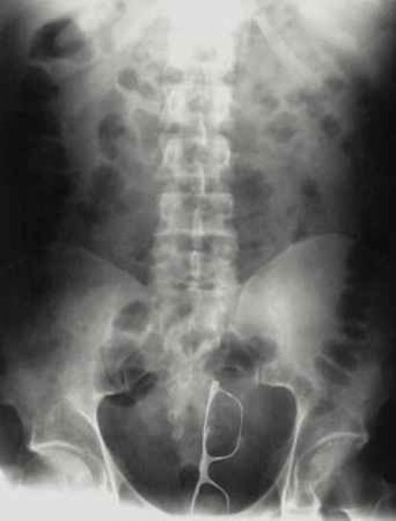 Je raadt nooit wat de dokters in hun patiënten vonden tijdens een X-ray scan