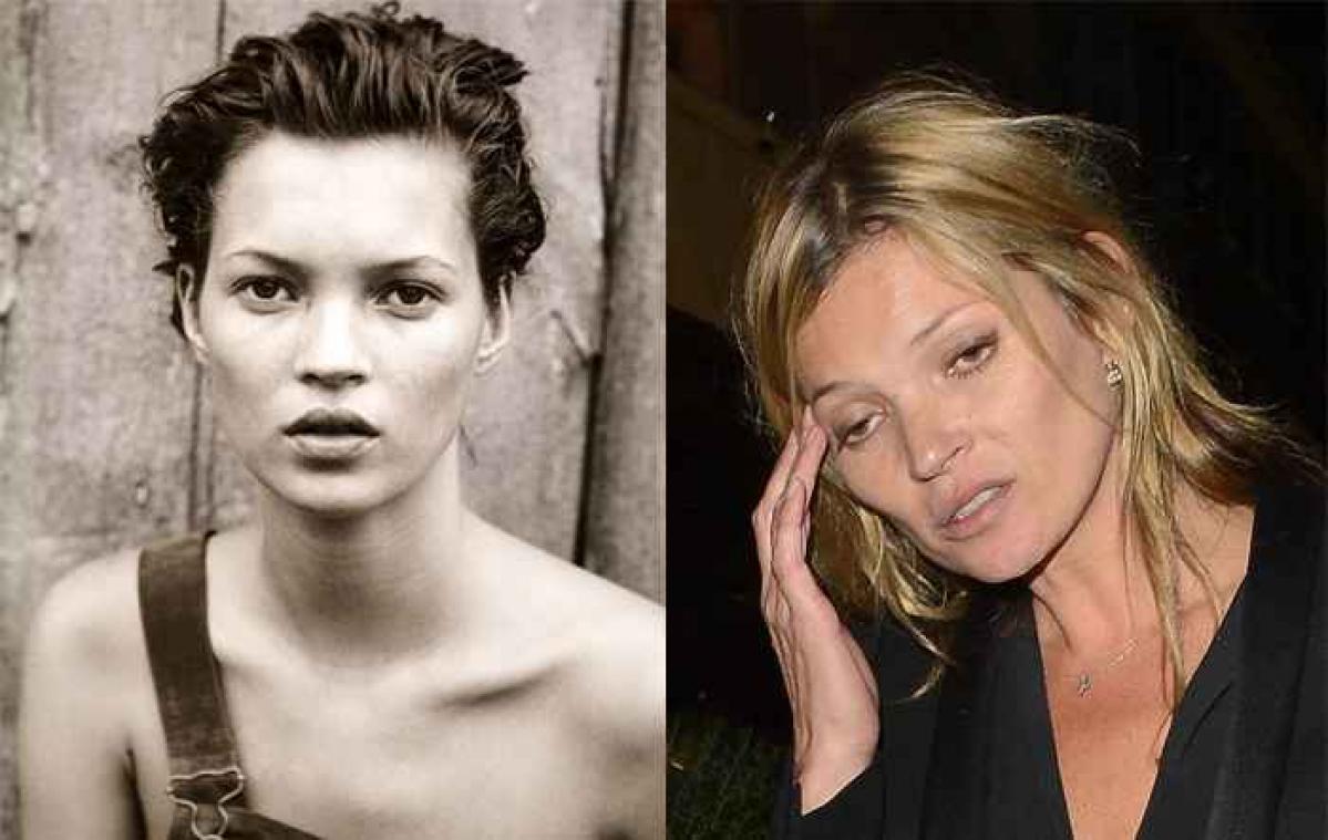 Top 10 minst flatterende foto's van Kate Moss