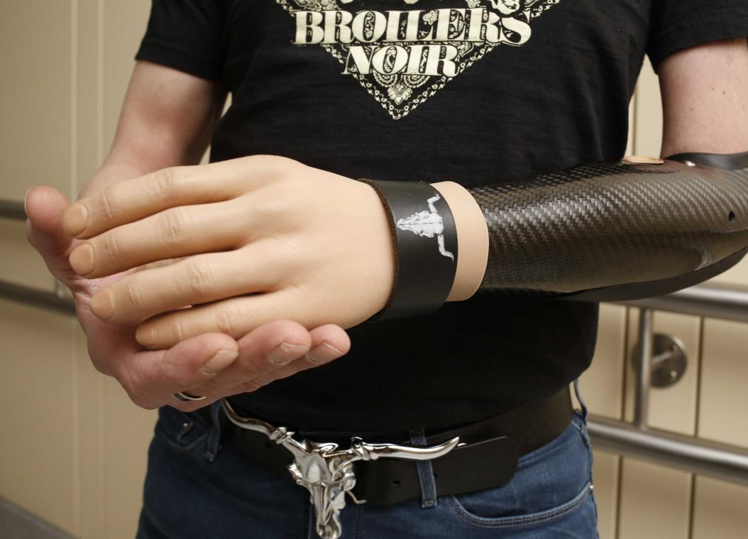 Eerste handprotheses gecontroleerd door de hersenen