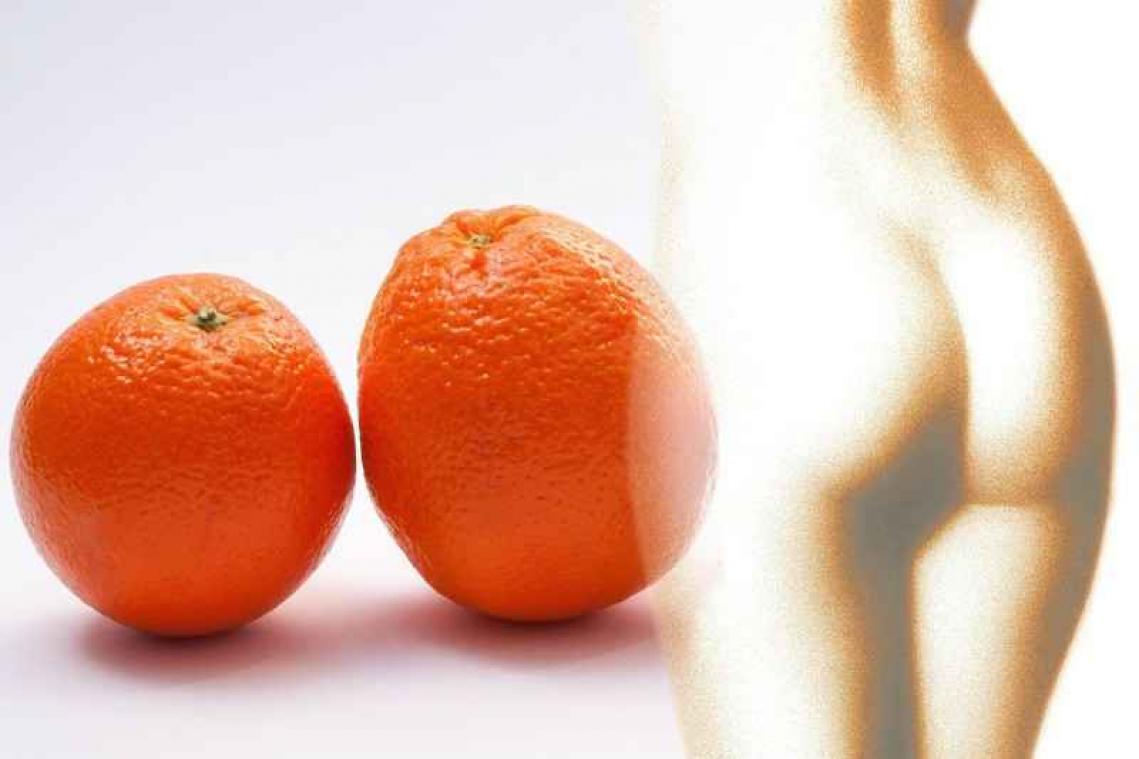 Video bewijst het: cellulitis is een optische illusie