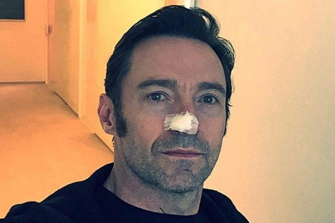 Hugh Jackman geopereerd voor huidkanker