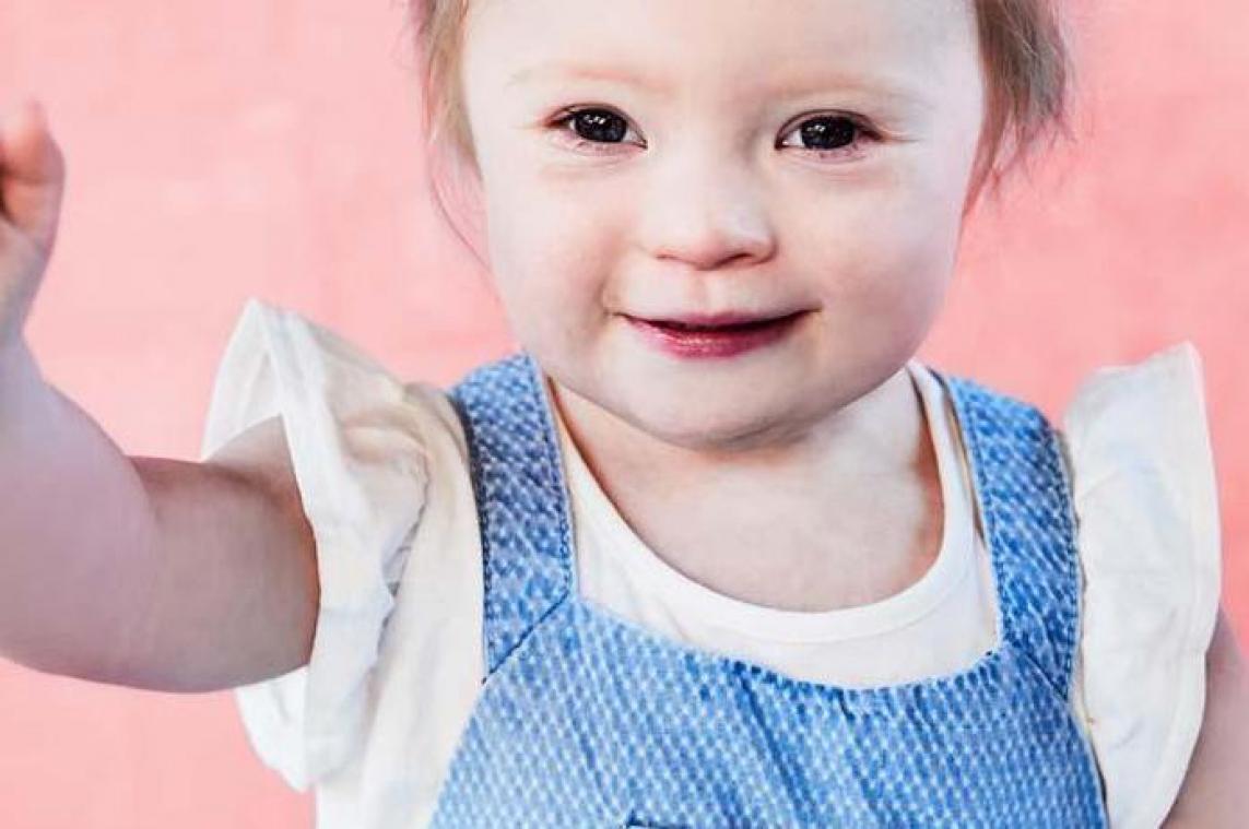 Peuter met Downsyndroom haalt modellencontract binnen