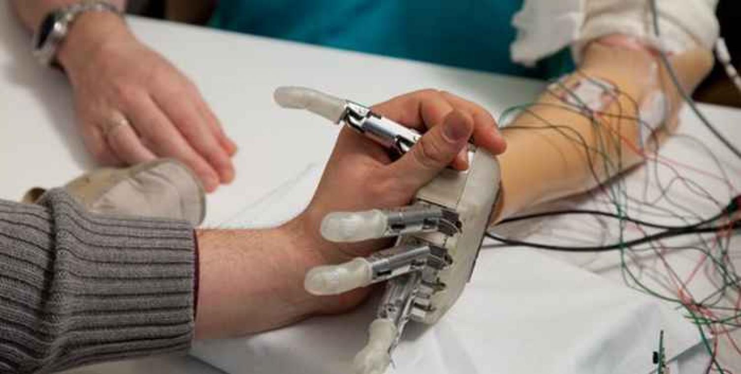 Bionische hand kan voelen