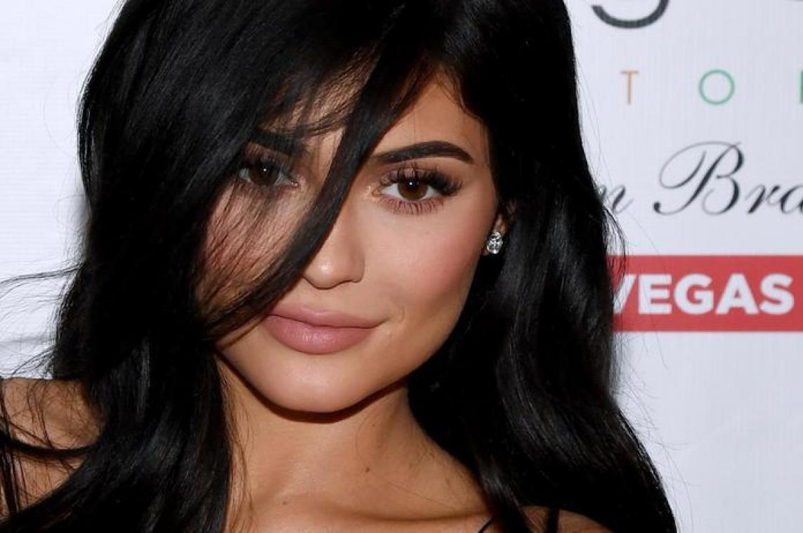 Kylie Jenner liet lippen opspuiten voor jongen