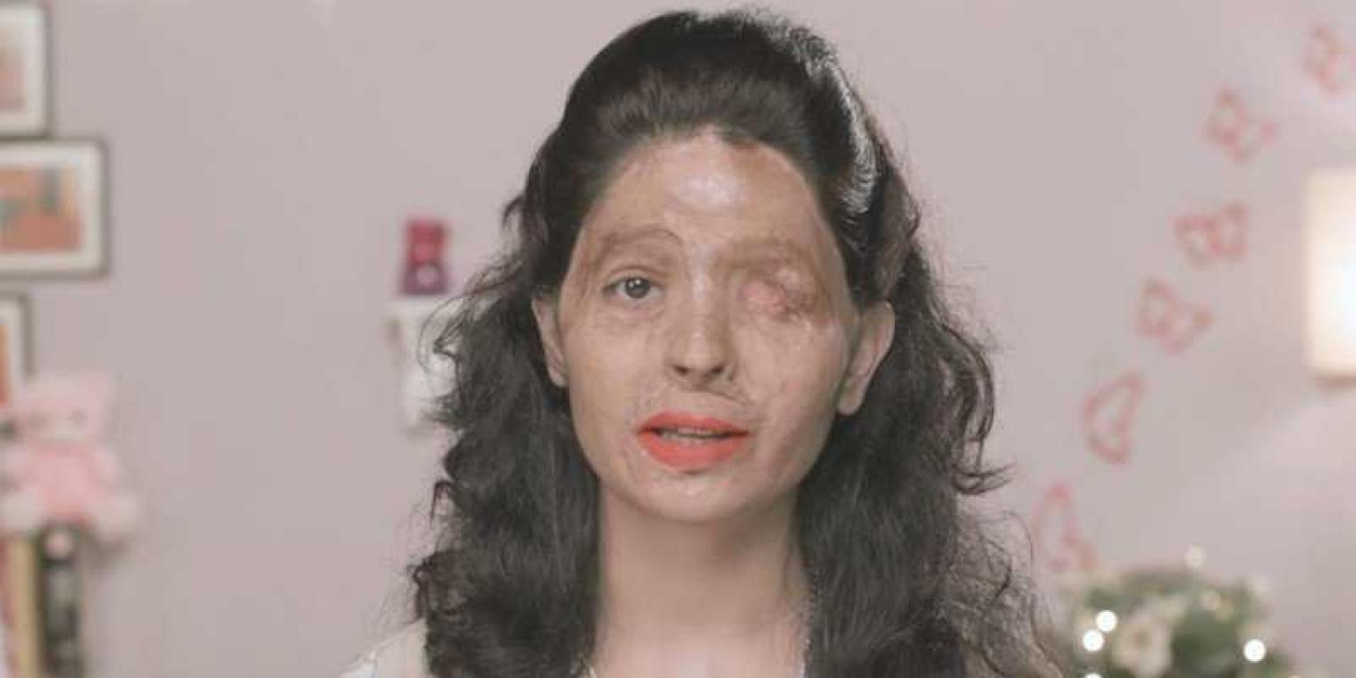 Slachtoffer van zuuraanval doet aangrijpende oproep in beauty tutorial