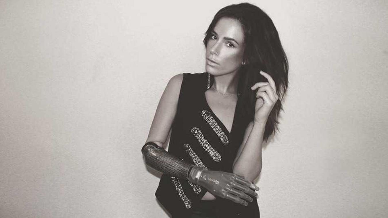 Model met bionische arm verovert plaats op de catwalk tijdens de New York Fashion week