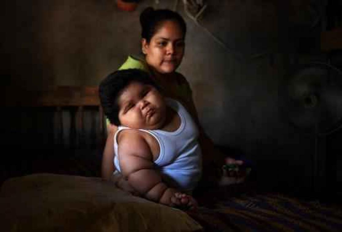 Mexicaanse baby van tien maanden weegt 28 kilo