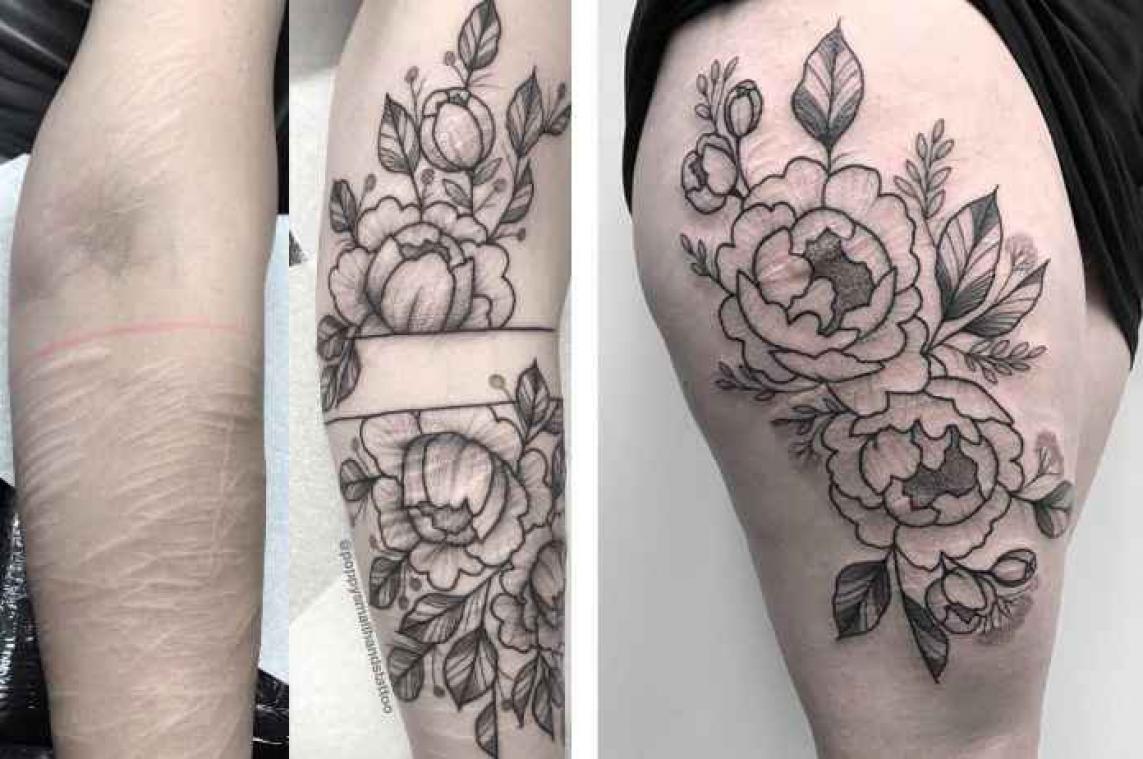 IN BEELD. De mooiste tattoos die littekens van zelfverminking verbergen