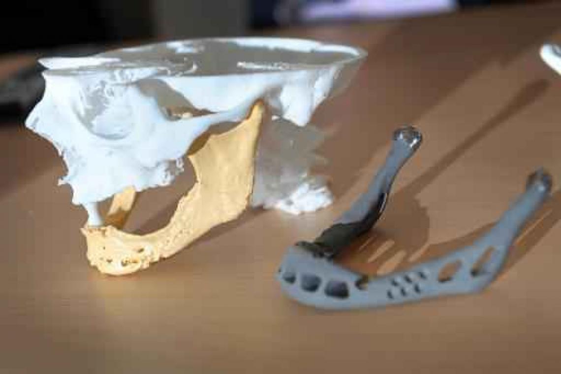 '3D geprinte implantaten niet aangetoond beter, veiliger of meer kosteneffectief'