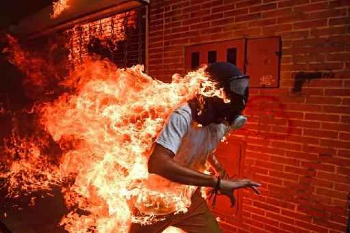 Foto van brandende man in Venezuela wint World Press Photo