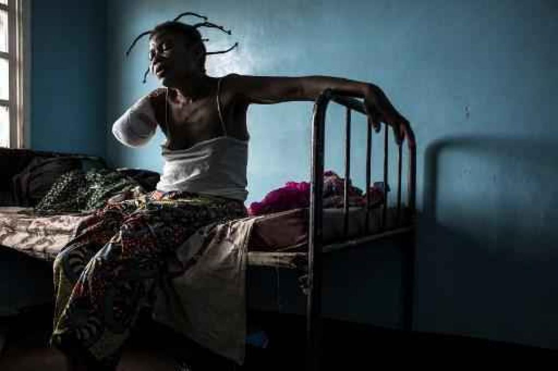Zeker 80 doden in Congolese conflictregio's in maart