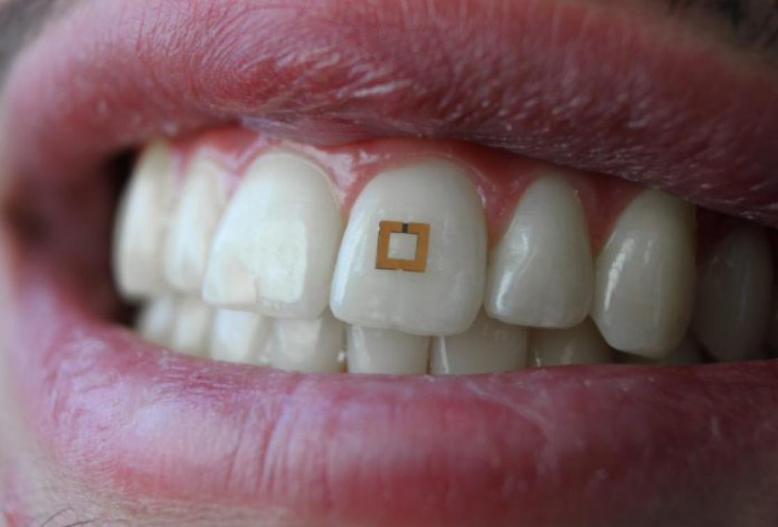 Deze sensor meet wat je eet