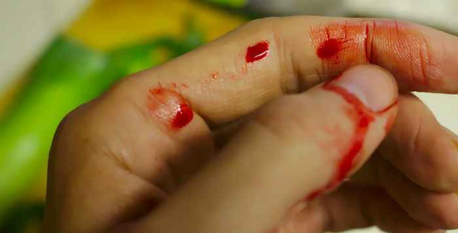 Zo kan je een papercut' genezen
