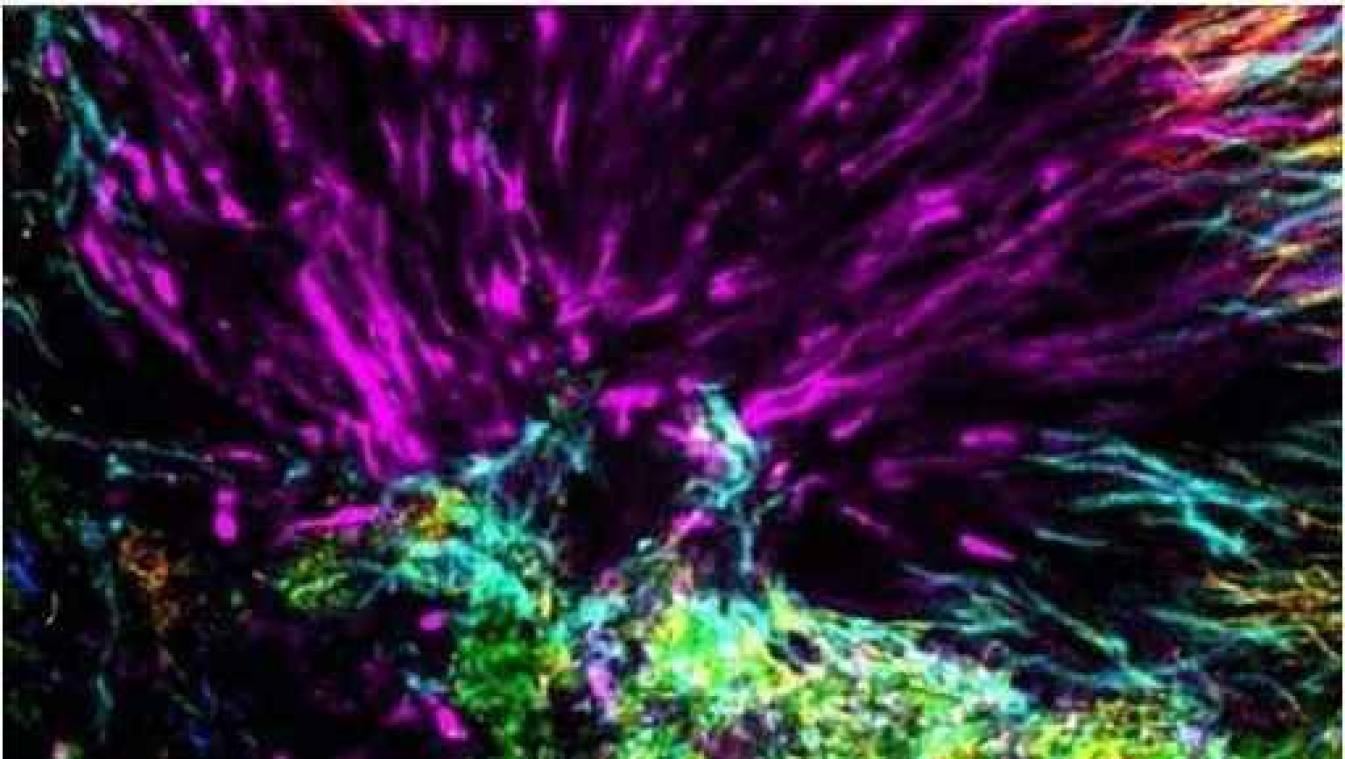 Zo zien de bacteriën in onze mond eruit