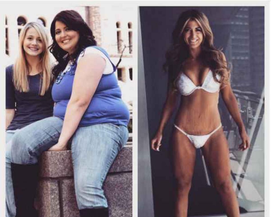 Van meisje met obesitas naar bikinimodel