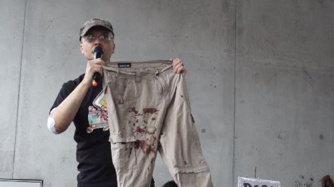 Slachtoffer mogelijk homofoob geweld in Gent: "Ik heb geluk dat ik nog leef"
