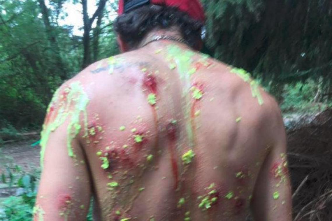 Auch! Naakte stuntman laat zich bekogelen met paintballgeweer