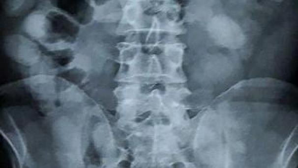 Edition numérique des abonnés