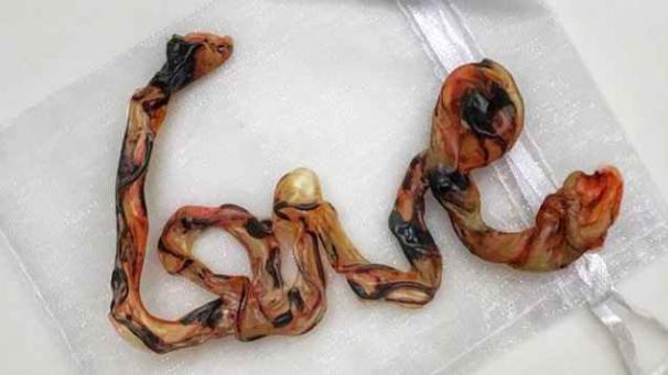 Edition numérique des abonnés